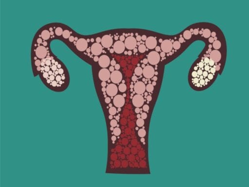 Women with endometriosis have terrible pain. There’s finally a new treatment.