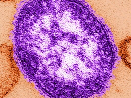 A new study on measles reveals a scary side effect: “immune-system amnesia”