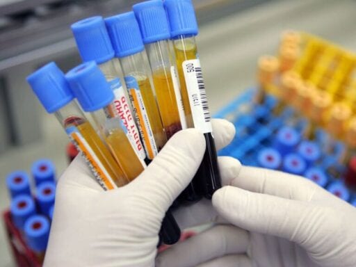 The CDC has begun testing blood for immunity against coronavirus