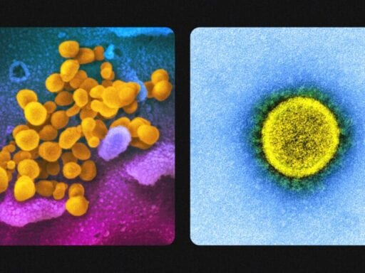 How images of the coronavirus are made